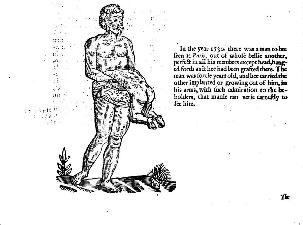 anthropos wonder body human monster marvel [source: Ambroise Pare - On Monsters and Marvels]